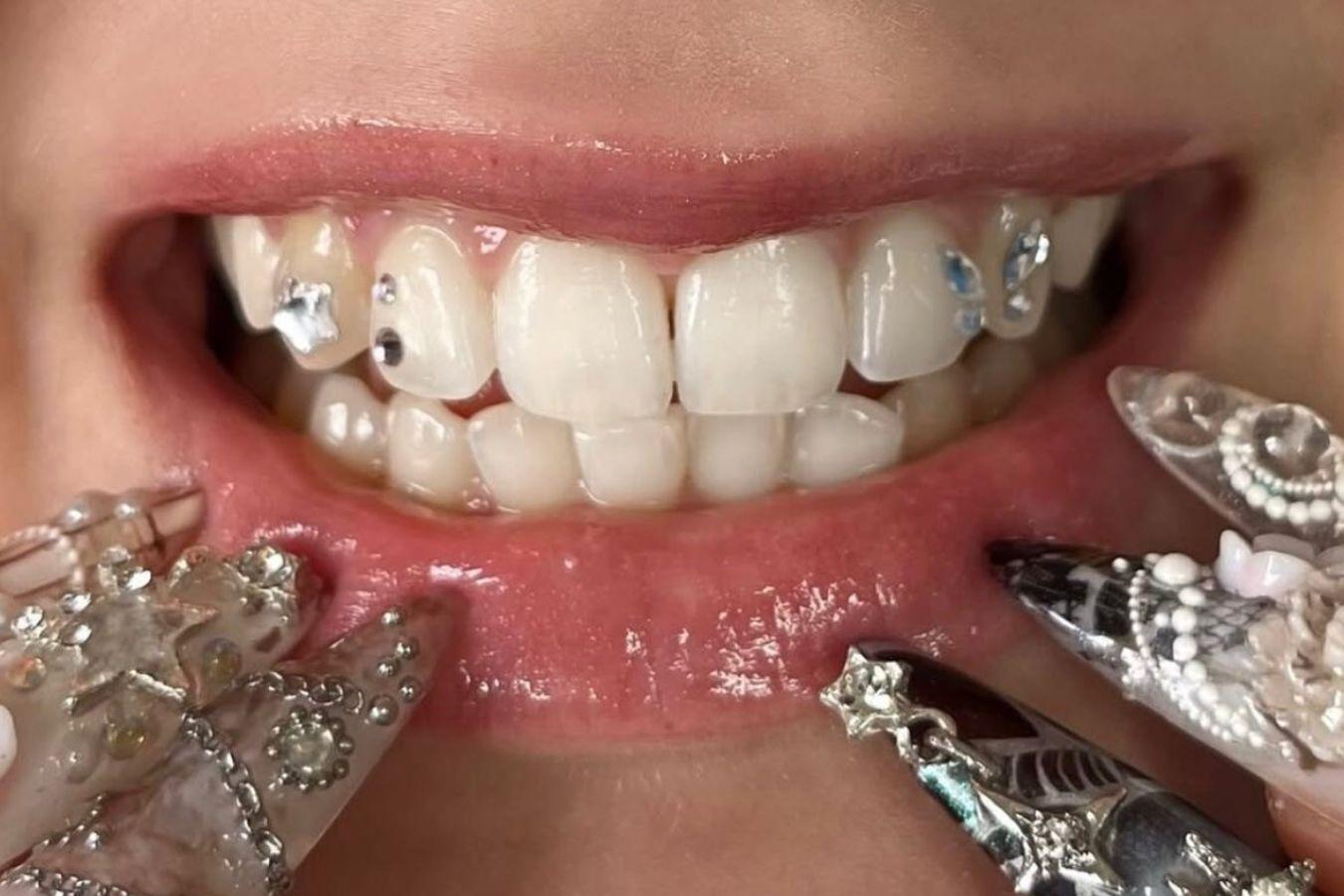 Close-up shot of teeth embellished with sparkling crystals.