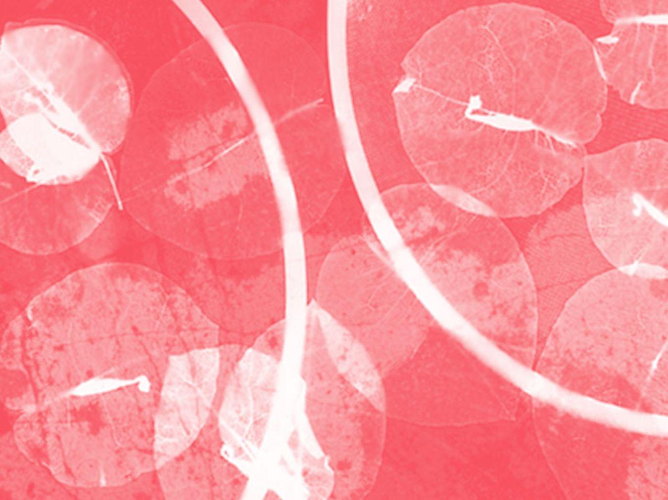 Fotogramm, Massimo Drago © Wikimedia Commons