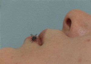 Eine Nahaufnahme des Profils einer Person vor hellblauem Hintergrund, auf deren Lippe eine Fliege sitzt.